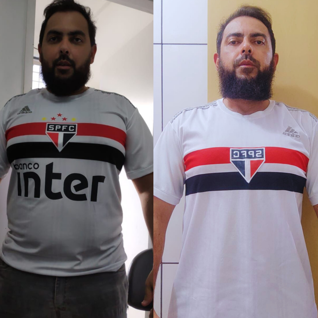 Antes e depois emagrecimento