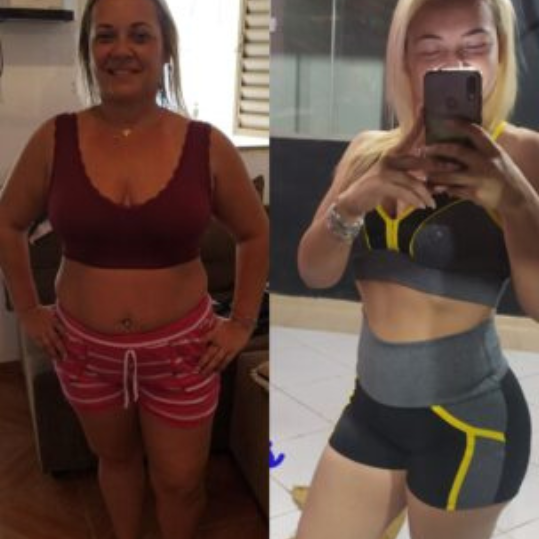 Antes e depois emagrecimento