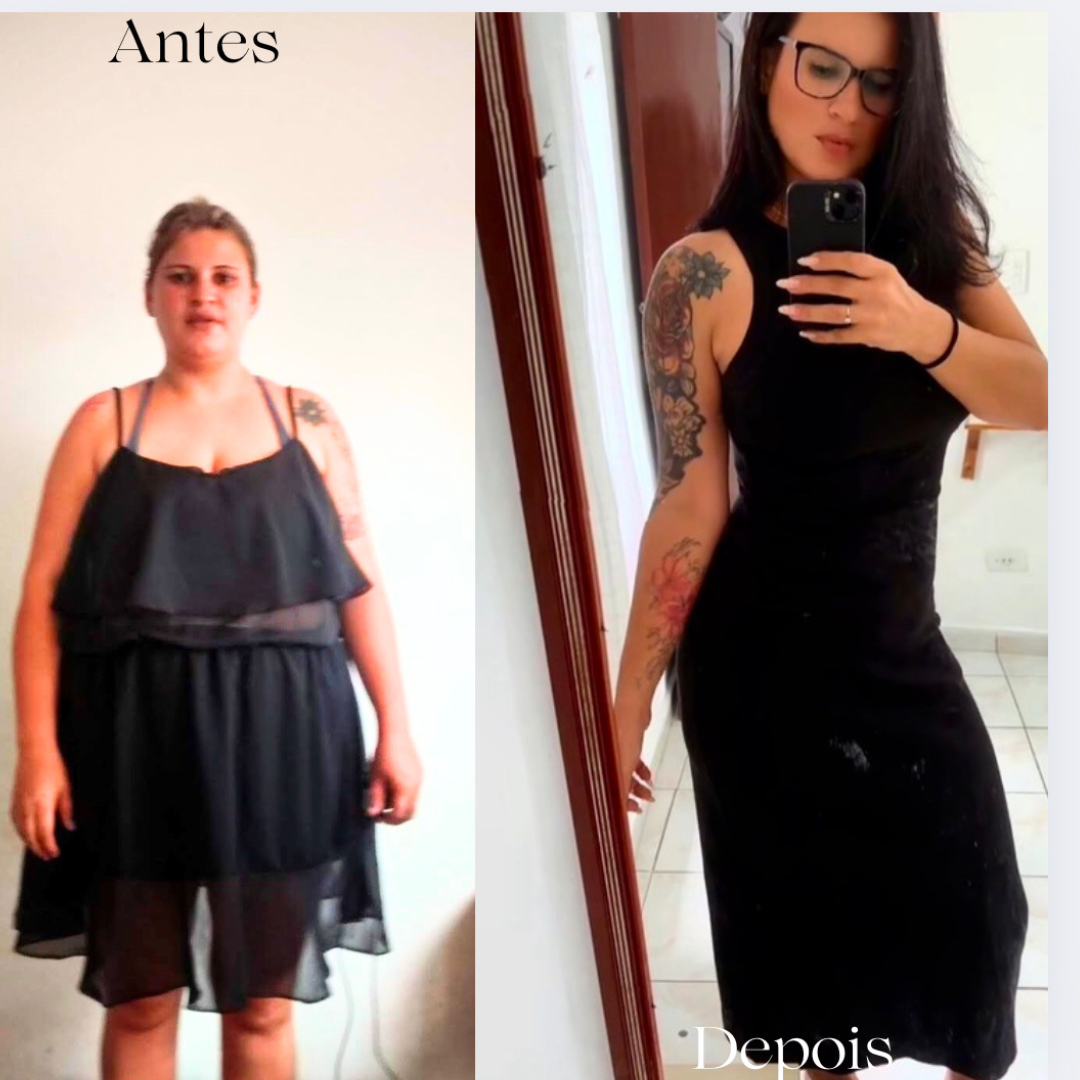 Antes e depois emagrecimento