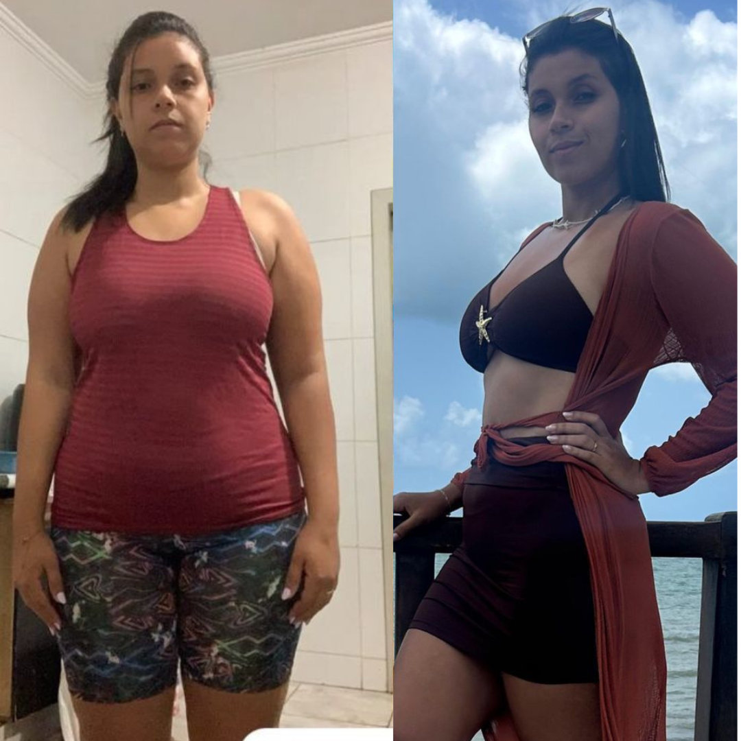 Antes e depois emagrecimento